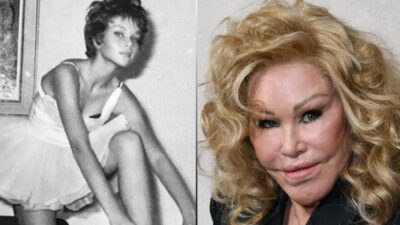 Jocelyn Wildenstein Before and After Plastic Surgery Journey