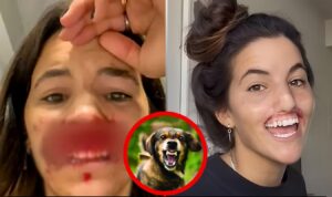 22-Year-Old Model's Lips Damaged by Pet Dog