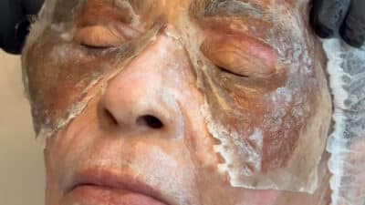 98-Year-Old Woman Looks 40 After Skin Therapy