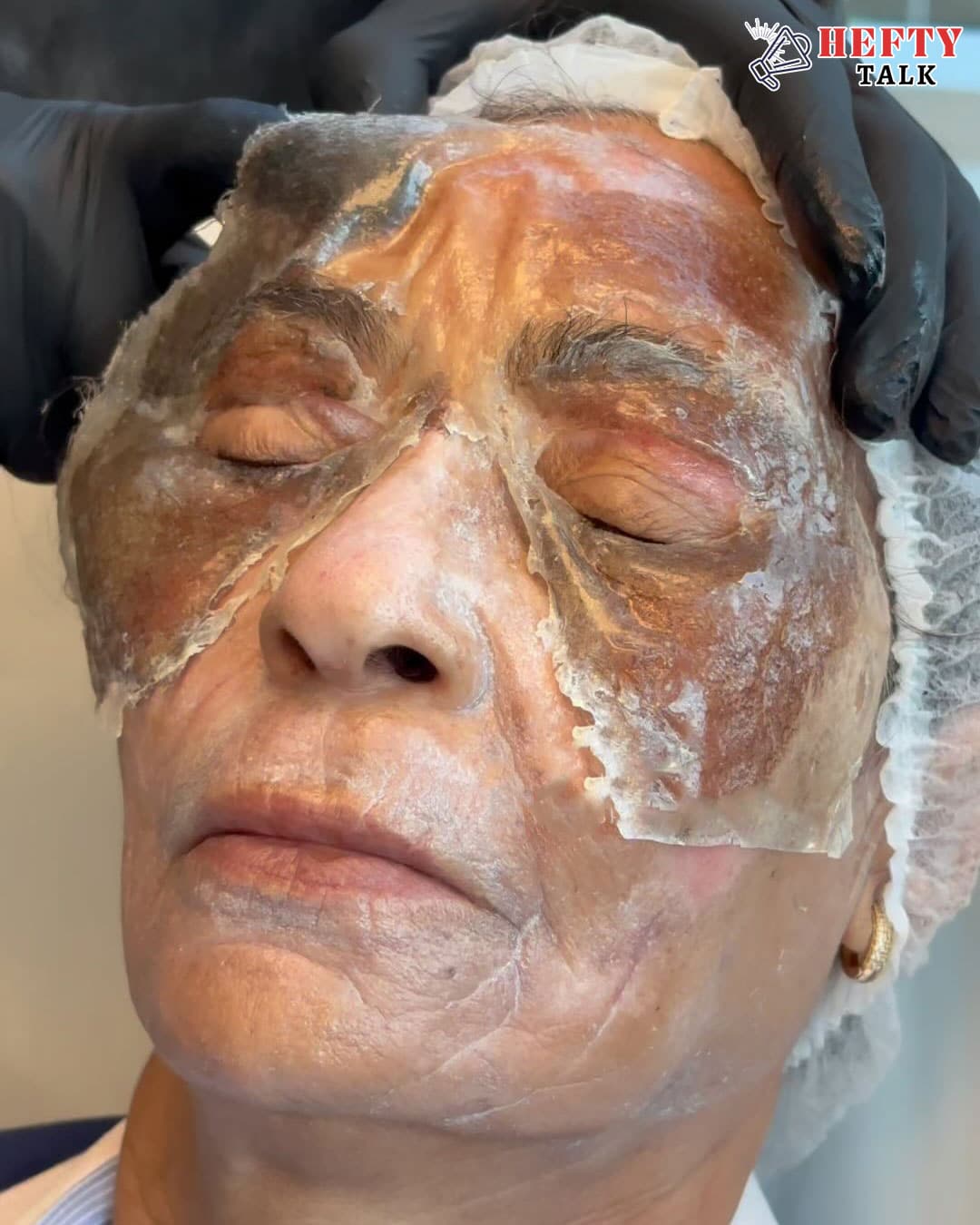 98-Year-Old Woman Looks 40 After Skin Therapy