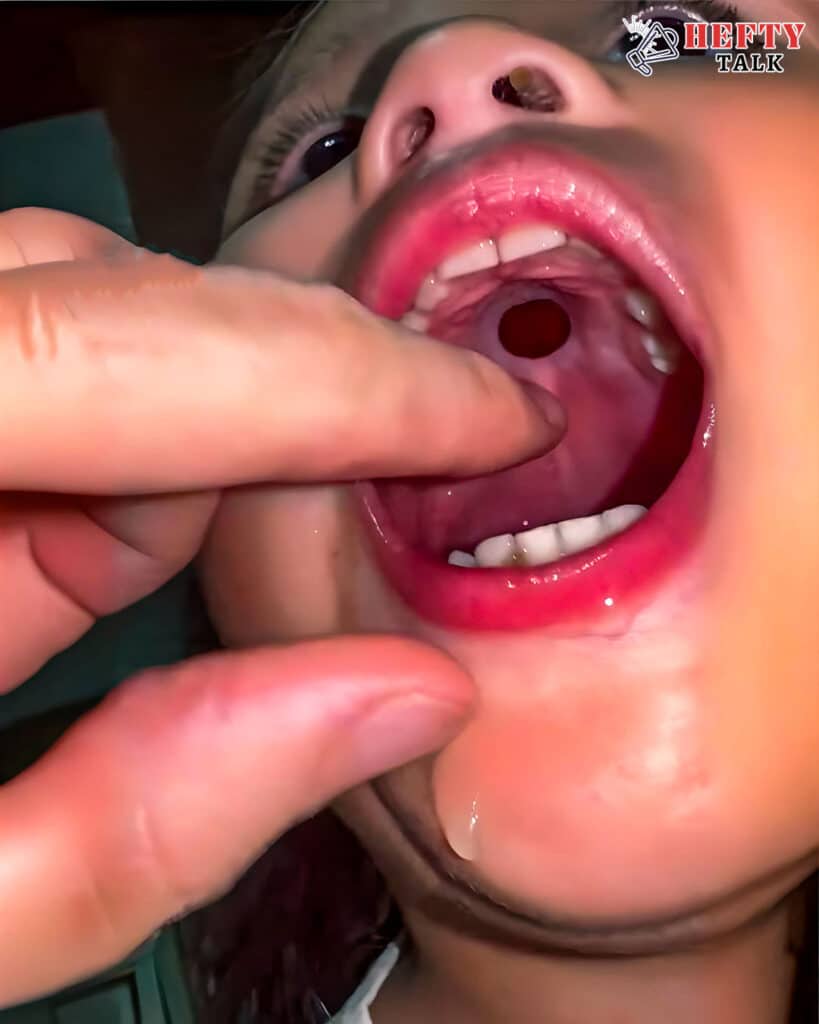 Boy’s Mystery Mouth Pain Reveals Shocking Discovery