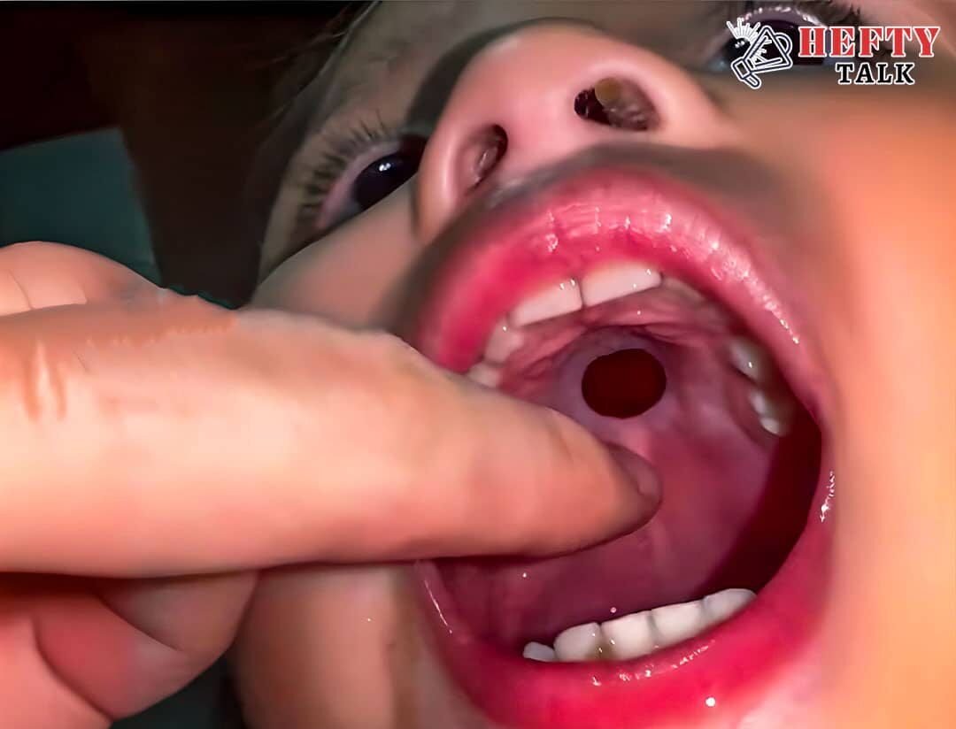 Boy’s Mystery Mouth Pain Reveals Shocking Discovery