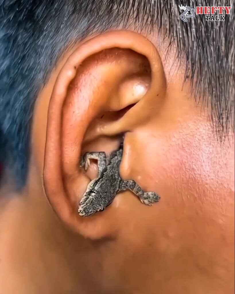 Lizard Found in Man’s Ear: Shocking Camping Story