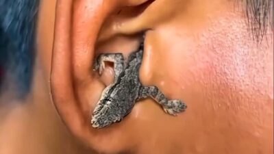 Lizard Found in Man’s Ear: Shocking Camping Story