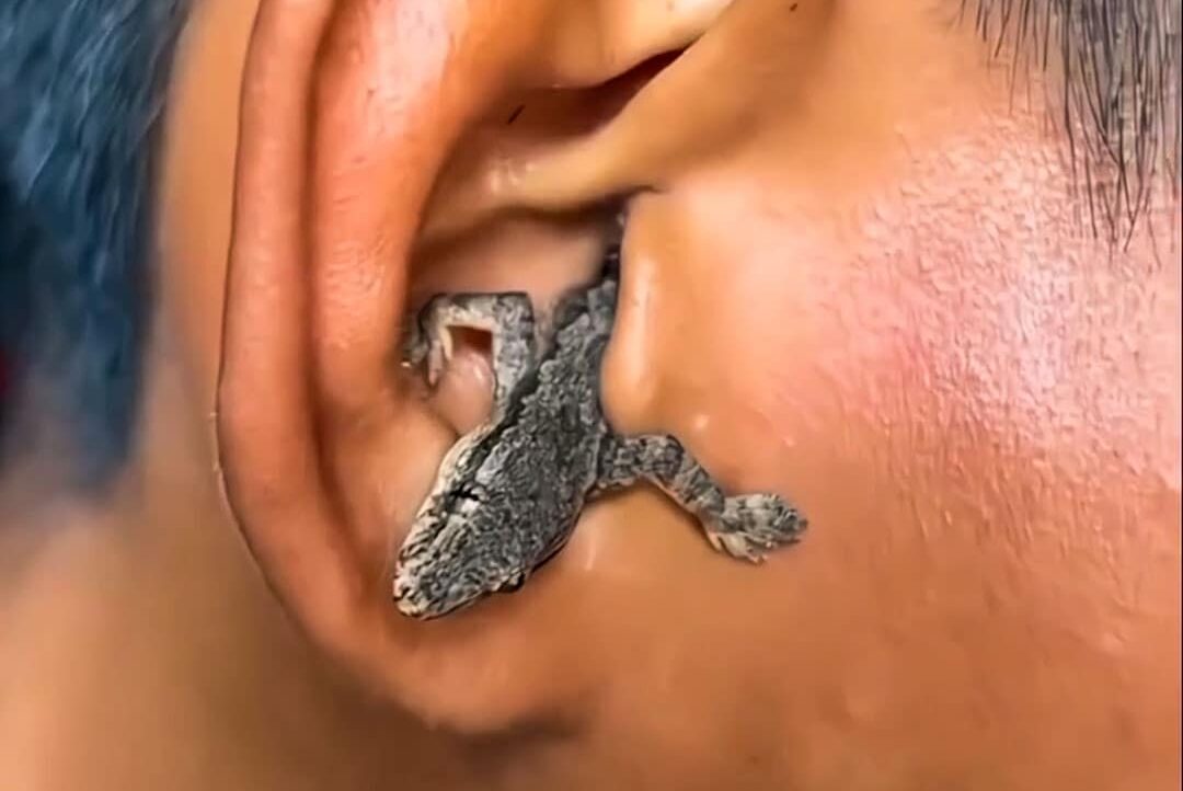 Lizard Found in Man’s Ear: Shocking Camping Story