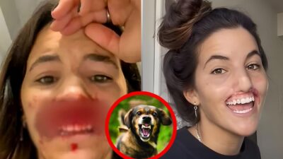 22-Year-Old Model's Lips Damaged by Pet Dog